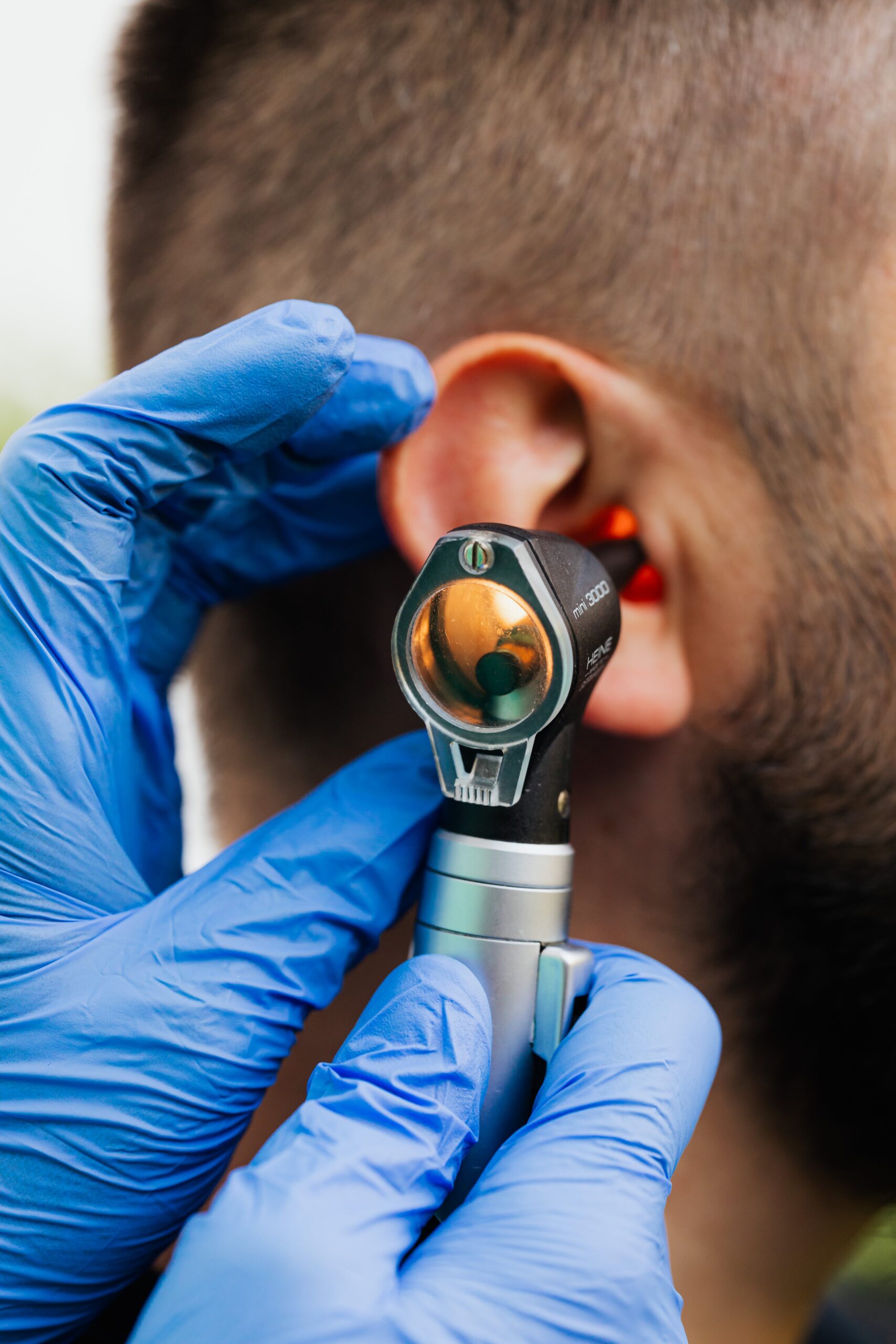 Ear Wax Removal Via Microsuction