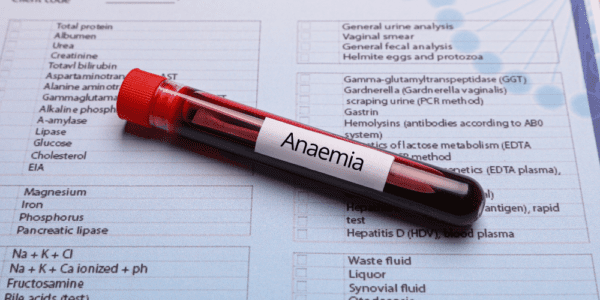 Anaemia Profile £175