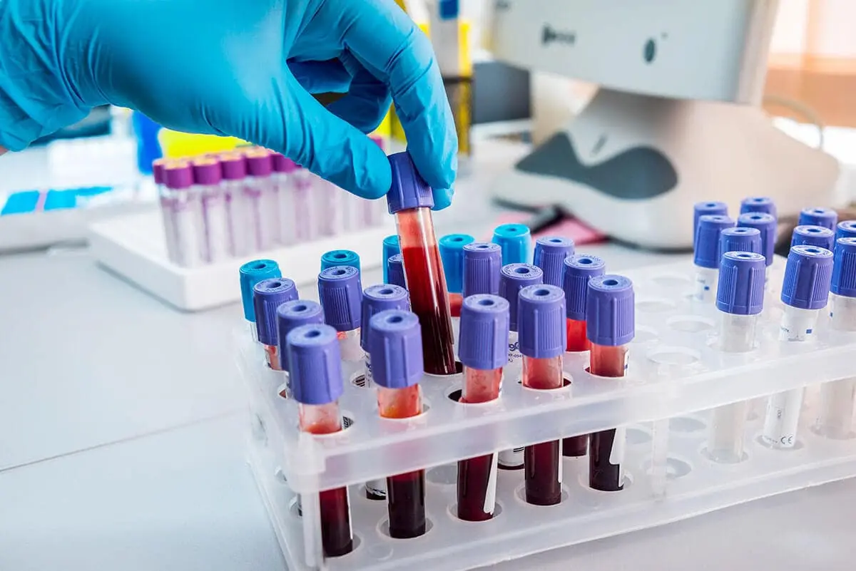 private blood test