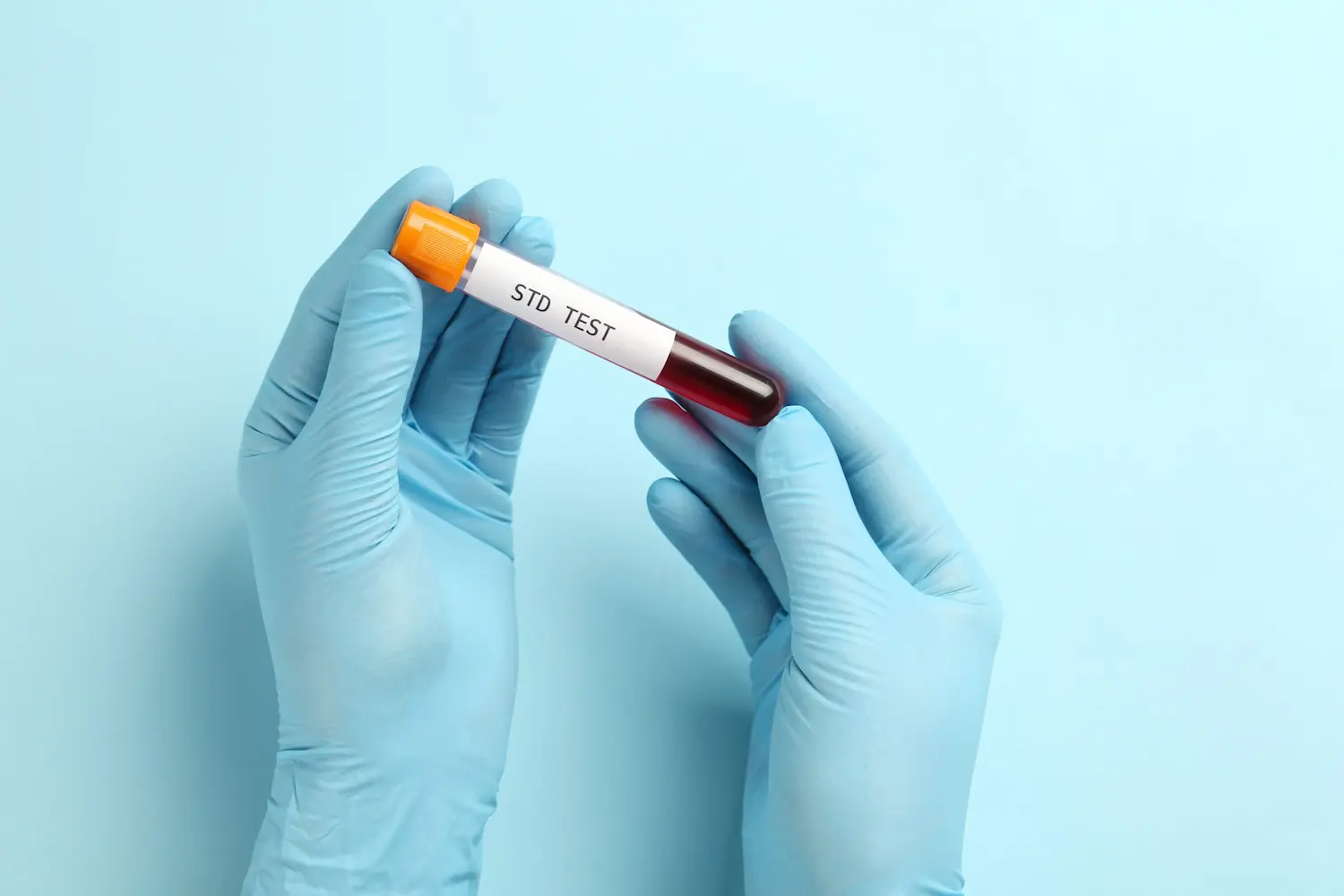 Std test