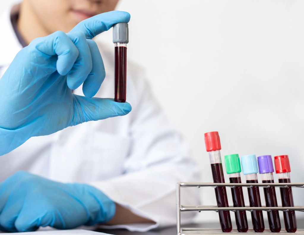 What is a PSA Test?