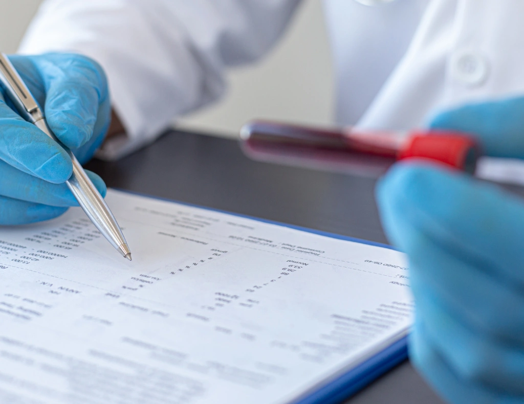 Why Choose PSA test in London